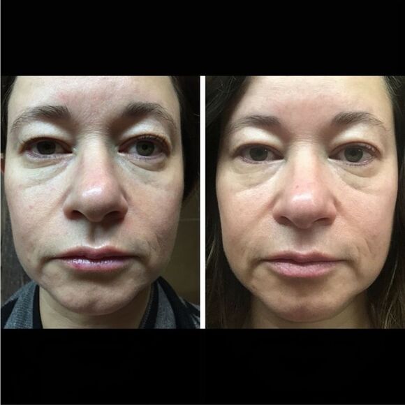 Verso Skincare Super Eye Serum w/ Retinol 8 - Picture 6 of 12